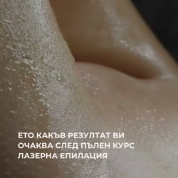 Клиента дойде за Процедура Преди да започне курс Лазерна Епилация Бикинито изглеждаше така от Лазерен център Дискрет Лазер Варна